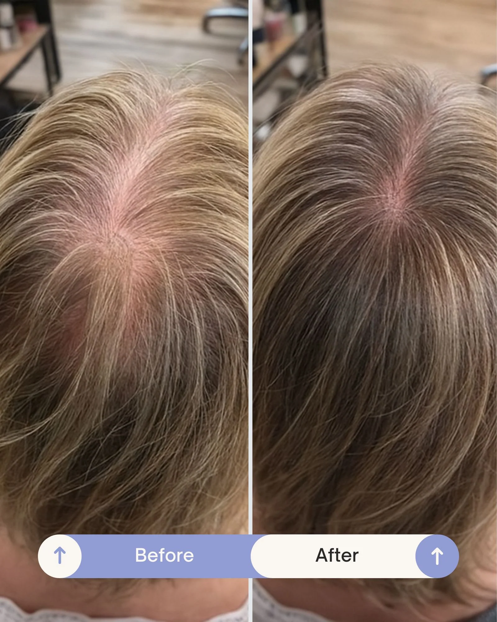 Grow Perfect™ Hair Growth Serum - Image 7