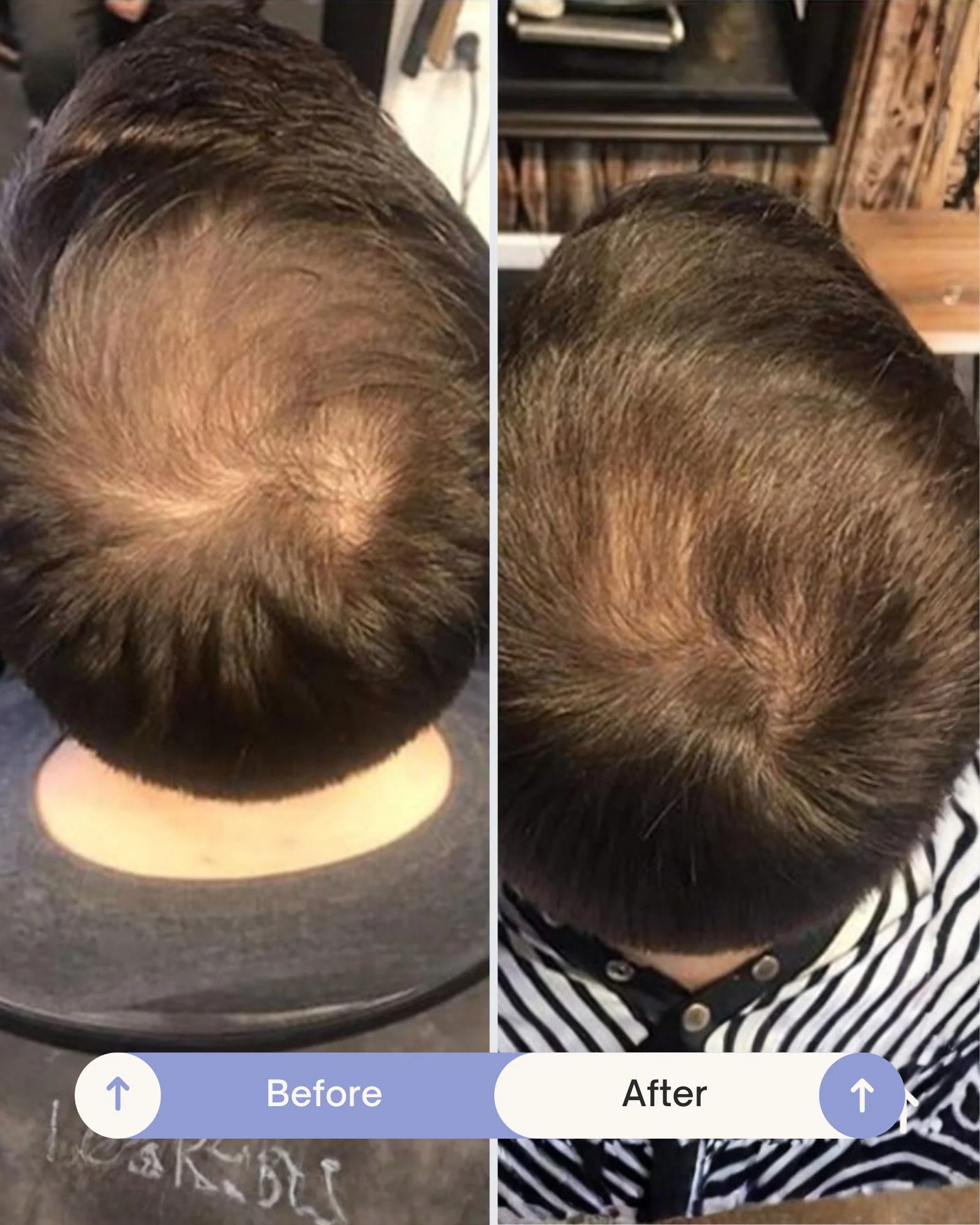 Grow Perfect™ Hair Growth Serum - Image 8