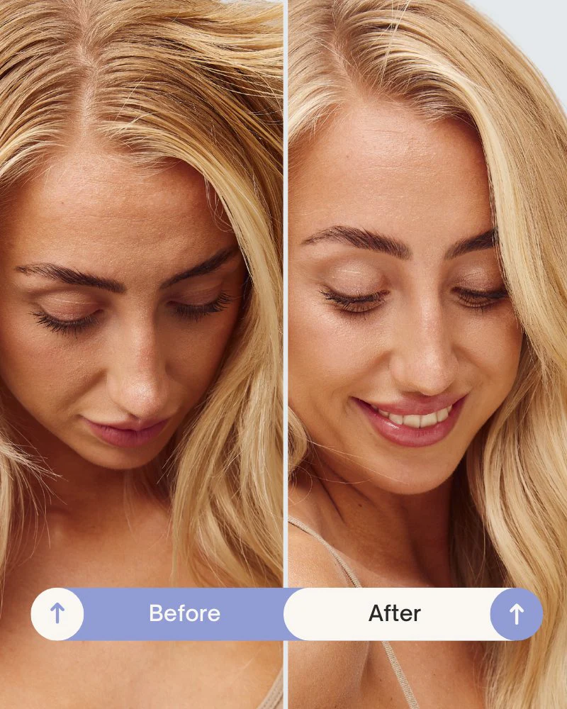 Refresh Powder™ Dry Shampoo - Image 6