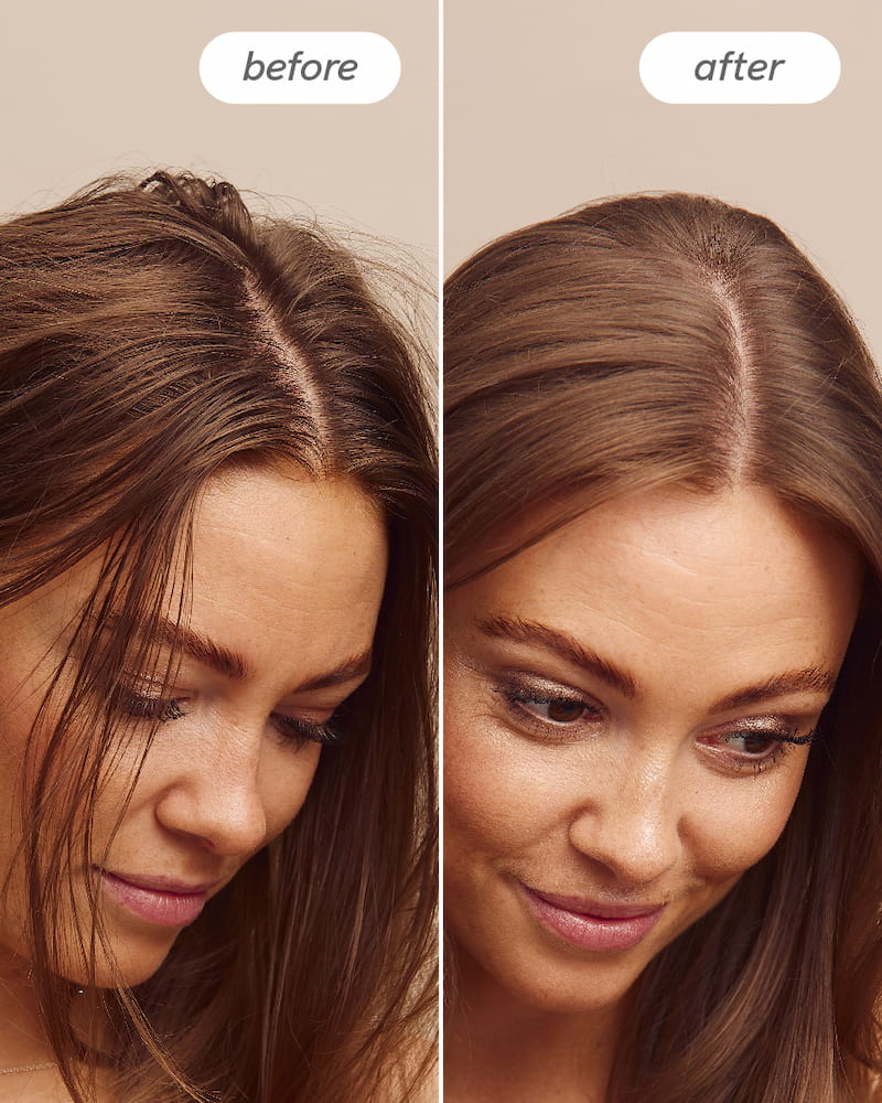 Scalp Delight™ Detox Scrub - Image 9
